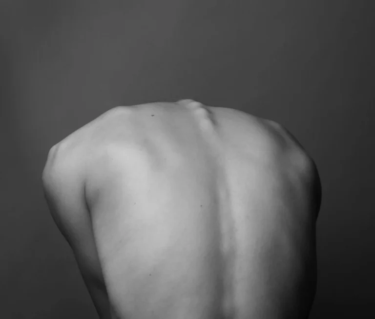 Ansicht eines menschlichen Rückens, der Kopf ist so weit nach vorne geneigt, dass man den Kopf nicht sieht.